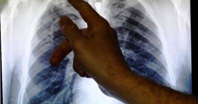Indonesia ramps up fight against tuberculosis amid concerns on economic impact