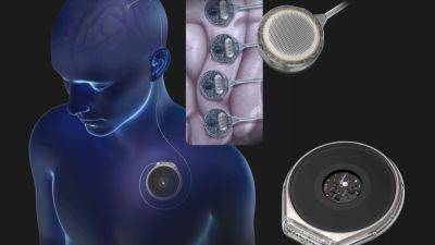 Neuralink competitor Paradromics gears up to test its brain implant on humans
