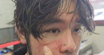 10 stitches on head: Thai-Singaporean singer left bruised and battered in Bangkok from altercation over woman - asiaone.com - Thailand - Singapore - city Bangkok