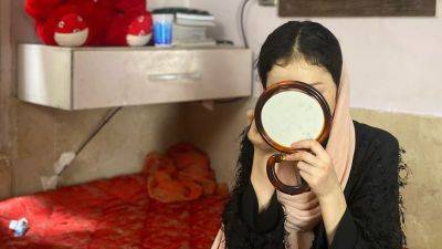 A year ago, she drank battery acid to escape life under the Taliban. Today, she has a message for other Afghan girls