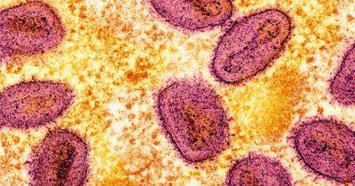 Philippines says 2 new mpox cases are milder variant - asiaone.com - Philippines - state Indiana - Congo - city Manila